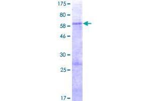 Image no. 1 for Solute Carrier Family 25, Member 33 (SLC25A33) (AA 1-321) protein (GST tag) (ABIN1320287)