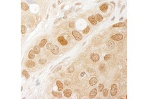 Immunohistochemistry (IHC) image for anti-V-Akt Murine Thymoma Viral Oncogene Homolog 1 (AKT1) (AA 25-75) antibody (ABIN7454546) (AKT1 anticorps  (AA 25-75))