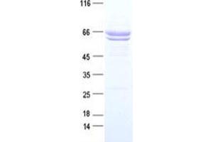 Validation with Western Blot