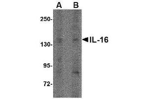 Western blot analysis of IL-16 in rat brain tissue lysate with AP30407PU-N IL-16 antibody at (A) 1 µg/ml and (B) 2 μg/ml. (IL16 anticorps  (N-Term))