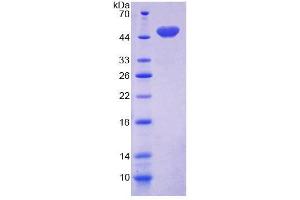Image no. 1 for CD164 (CD164) (AA 24-162) protein (GST tag,His tag) (ABIN4988759) (CD164 Protein (CD164) (AA 24-162) (GST tag,His tag))