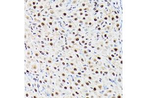 Immunohistochemistry of paraffin-embedded rat ovary using A Rabbit pAb (ABIN6129868, ABIN6136479, ABIN6136480 and ABIN6221034) at dilution of 1:100 (40x lens). (BAF53A anticorps  (AA 1-280))