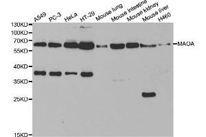 Western blot analysis of extracts of various cell lines, using MAOA antibody (ABIN5970633) at 1/1000 dilution. (Monoamine Oxidase A anticorps)