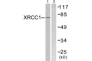 Western blot analysis of extracts from Jurkat cells, using XRCC1 antibody. (XRCC1 anticorps  (C-Term))