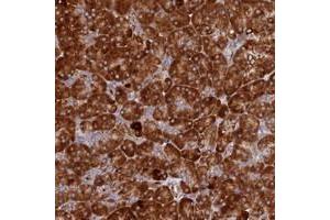 Immunohistochemical staining of human pancreas with C12orf60 polyclonal antibody  shows strong cytoplasmic positivity in exocrine glandular cells at 1:500-1:1000 dilution. (C12orf60 anticorps)