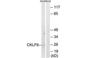 Western Blotting (WB) image for anti-CKLF-Like MARVEL Transmembrane Domain Containing 6 (CMTM6) (AA 131-180) antibody (ABIN2890222) (CMTM6 anticorps  (AA 131-180))