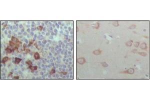Immunohistochemical analysis of paraffin-embedded human lymph node (left) and brain (right), showing cytoplasmic localization with DAB staining using EhpB6 mouse mAb. (EPH Receptor B6 anticorps  (AA 601-750))