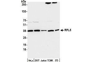 anti-Ribosomal Protein L5 (RPL5) (AA 247-297) antibody