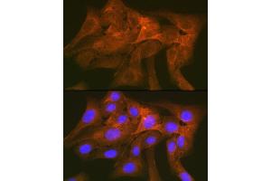Immunofluorescence analysis of U-2 OS cells using CD172a/SIRPα Rabbit mAb (ABIN7270316) at dilution of 1:100 (40x lens).