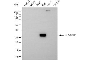 Western blotting analysis using HLA-DRB5 antibody (ABIN7799324).