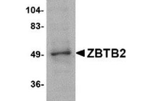 Western blot analysis of ZBTB2 in PC-3 cell lysate with this product at 1 μg/ml. (ZBTB2 anticorps  (Center))