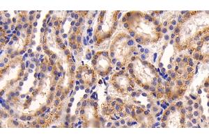 Detection of CASP3 in Rat Kidney Tissue using Polyclonal Antibody to Caspase 3 (CASP3)