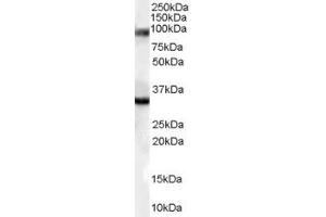 Western Blotting (WB) image for anti-Bone Morphogenetic Protein 8A (BMP8A) (Middle Region) antibody (ABIN2789951) (BMP8A anticorps  (Middle Region))