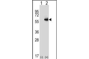 Western blot analysis of ALDH4A1 (arrow) using rabbit polyclonal ALDH4A1 Antibody (Center) (ABIN392357 and ABIN2841996). (ALDH4A1 anticorps  (AA 288-314))