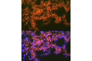 Immunofluorescence analysis of rat lung using Mesothelin Rabbit mAb (ABIN7268478) at dilution of 1:100 (40x lens).