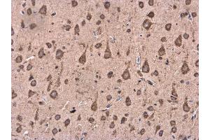 IHC-P Image BACE1 antibody [N1C2] detects BACE1 protein at cytoplasm in Rat brain by immunohistochemical analysis. (BACE1 anticorps)