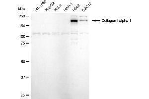 Western blotting analysis using collagen I alpha 1 antibody (ABIN7798123).