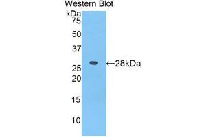Western blot analysis of the recombinant protein. (alpha 2 Macroglobulin anticorps  (AA 157-389))