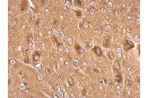 IHC-P Image Synaptophysin antibody detects Synaptophysin protein at on rat fore brain by immunohistochemical analysis. (Synaptophysin anticorps  (C-Term))