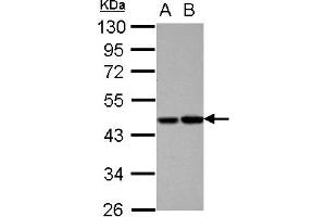 Western Blotting (WB) image for anti-Vitamin K-dependent protein C (PROC) (AA 1-236) antibody (ABIN1500426) (PROC anticorps  (AA 1-236))
