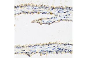 Immunohistochemistry of paraffin-embedded human prostate using SPINT1 antibody at dilution of 1:100 (40x lens). (SPINT1 anticorps)