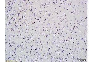 Formalin-fixed and paraffin embedded mouse spleen tissue labeled with Anti-HDAC5 Polyclonal Antibody, Unconjugated (ABIN681043) at 1:200 followed by conjugation to the secondary antibody and DAB staining
