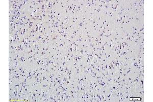 Formalin-fixed and paraffin embedded mouse spleen tissue labeled with Anti-HDAC5 Polyclonal Antibody, Unconjugated (ABIN681043) at 1:200 followed by conjugation to the secondary antibody and DAB staining (HDAC5 anticorps)
