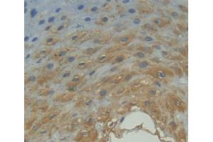 Used in DAB staining on fromalin fixed paraffin- embedded esophagus tissue
