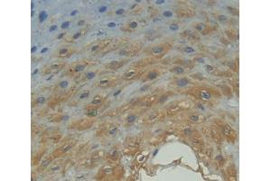 Used in DAB staining on fromalin fixed paraffin- embedded esophagus tissue (FPGT anticorps  (AA 127-377))