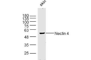Mouse skin lysates probed with Nectin 4 Polyclonal Antibody, Unconjugated  at 1:300 dilution and 4˚C overnight incubation.