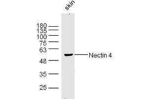 Mouse skin lysates probed with Nectin 4 Polyclonal Antibody, Unconjugated  at 1:300 dilution and 4˚C overnight incubation. (PVRL4 anticorps  (AA 151-250))