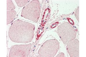 Anti-INPP5K / SKIP antibody IHC staining of human skeletal muscle. (INPP5K anticorps  (AA 183-430))