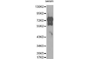 Western Blotting (WB) image for anti-Vitronectin (VTN) (AA 364-478) antibody (ABIN3022358)