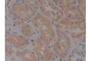 DAB staining on IHC-P; Samples: Human Kidney Tissue