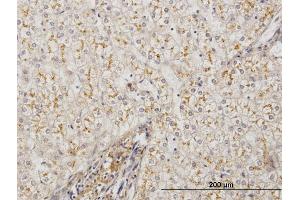 Immunoperoxidase of monoclonal antibody to AMBP on formalin-fixed paraffin-embedded human liver.