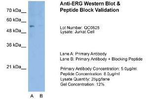 Host:  Rabbit  Target Name:  ERG  Sample Type:  Jurkat  Lane A:  Primary Antibody  Lane B:  Primary Antibody + Blocking Peptide  Primary Antibody Concentration:  1. (ERG anticorps  (Middle Region))