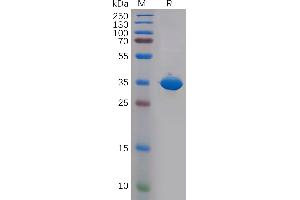 Human CD81 Protein, hFc Tag on SDS-PAGE under reducing condition.
