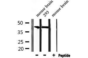 Western blot analysis of extracts from 293 and mouse brain, using CBX6 Antibody.