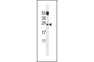 C Antibody (N-term) (ABIN656853 and ABIN2846058) western blot analysis in mouse testis tissue lysates (35 μg/lane). (CT011 Protein anticorps  (N-Term))