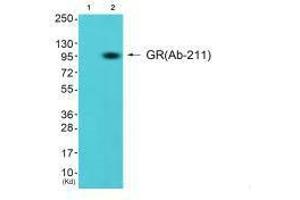 Western blot analysis of extracts from K562 cells (Lane 2), using GR (Ab-211) antiobdy. (Glucocorticoid Receptor anticorps  (Ser211))