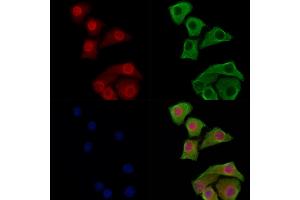 Phospho-JIP1 (Thr103) Antibody staining Hela cells(heat shock treatment) by IF/ICC. (MAPK8IP1 anticorps  (pThr103))