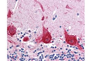 Anti-BFAR antibody IHC of human brain, cerebellum. (BFAR anticorps  (C-Term))
