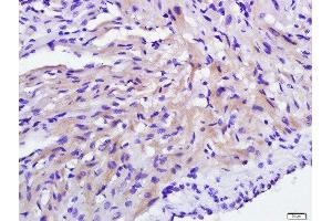 Paraformaldehyde-fixed, paraffin embedded rat heart, Antigen retrieval by boiling in sodium citrate buffer (pH6) for 15min, Block endogenous peroxidase by 3% hydrogen peroxide for 30 minutes, Blocking buffer (normal goat serum) at 37°C for 20min, Antibody incubation with 	C21orf33 Polyclonal Antibody, Unconjugated  at 1:500 overnight at 4°C, followed by a conjugated secondary and DAB staining.
