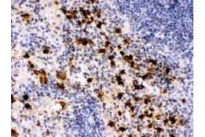 Anti- S100A9 Picoband antibody, IHC(P) IHC(P): Mouse Spleen Tissue (S100A9 anticorps  (AA 2-113))