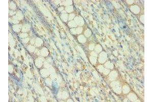 Immunohistochemistry of paraffin-embedded human colon tissue using ABIN7145226 at dilution of 1:100