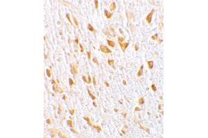 Immunohistochemistry of AGAP2 in mouse brain tissue with AGAP2 polyclonal antibody  at 10 ug/mL . (AGAP2 anticorps  (C-Term))