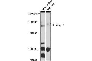 Western blot analysis of extracts of various cell lines, using CECR2 antibody (ABIN6127614, ABIN6138391, ABIN6138392 and ABIN6214290) at 1:1000 dilution. (CECR2 anticorps  (AA 170-370))