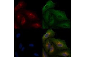 ABIN6265066 and ABIN6266633 staining  cells by IF/ICC.