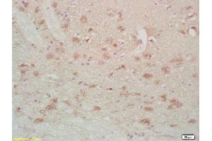 Formalin-fixed and paraffin embedded rat brain labeled with Anti-FABPB Polyclonal Antibody, Unconjugated (ABIN677888) at 1:200, followed by conjugation to the secondary antibody and DAB staining (FABP7 anticorps  (AA 1-100))