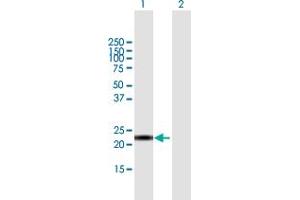 Western Blot analysis of CALML6 expression in transfected 293T cell line by CALML6 MaxPab polyclonal antibody. (CALML6 anticorps  (AA 1-181))